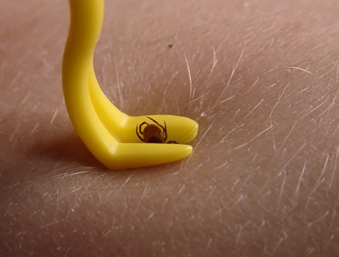 Yellow tick-removal hook lifting a tick off the skin